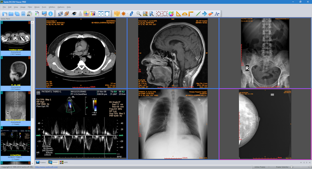 HTML5 DICOM viewer