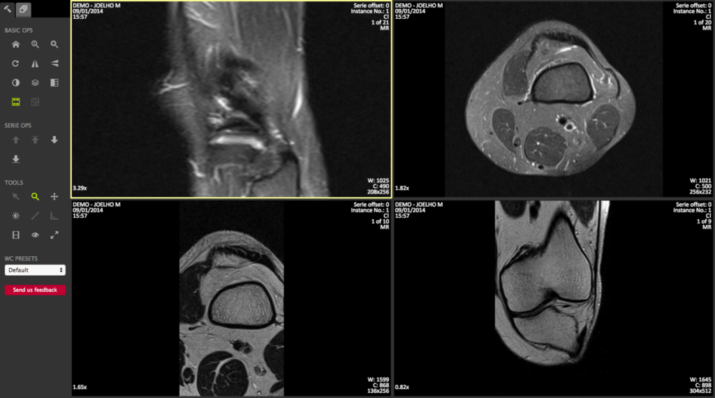 HTML5 DICOM viewer